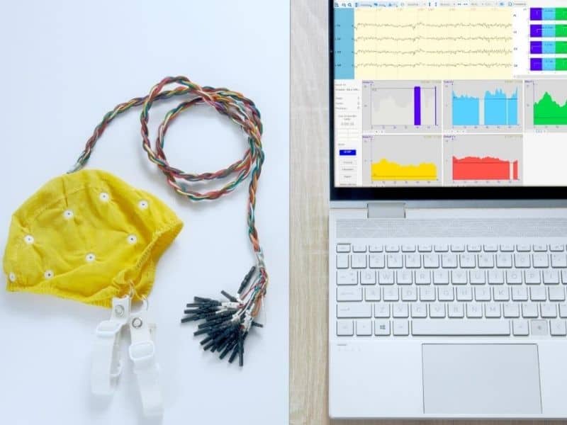 Biofeedback Analiza QEEG 1